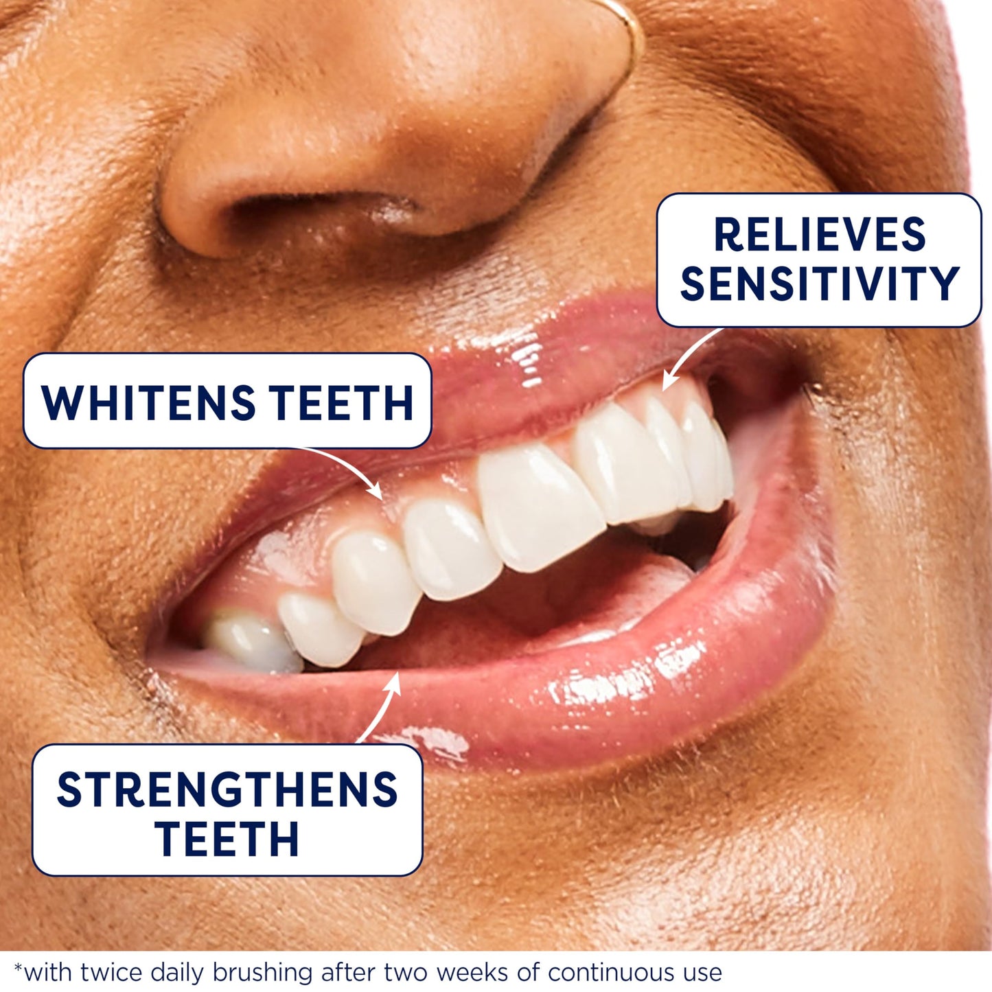Colgate Sensitive Toothpaste, Complete Protection, Mint - 6 Ounce (Pack of 3)